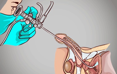 urólogo en guayaquil