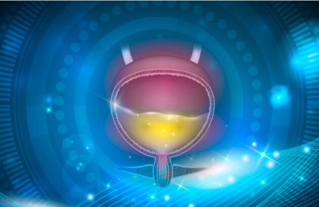 Infecciones urinarias uretritis