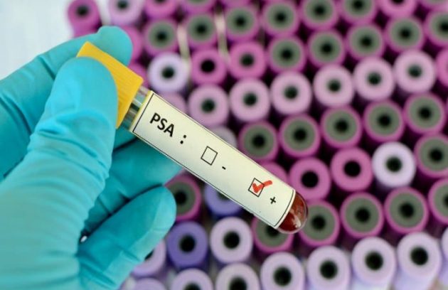 PSA antigeno prostático